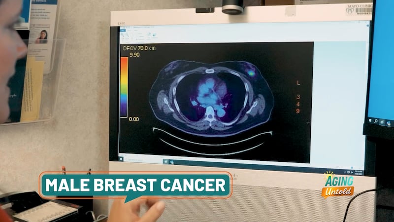 Men can get breast cancer despite a common misconception that it's a woman's disease.