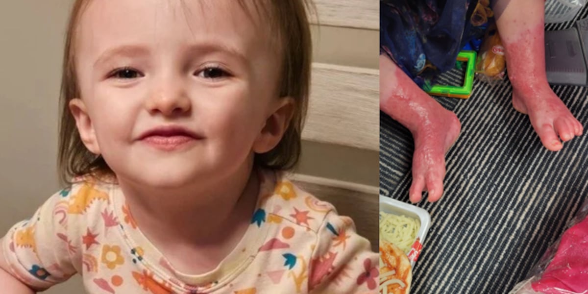 Kansas family seeks harsher sentence after toddler suffers burn injuries at daycare